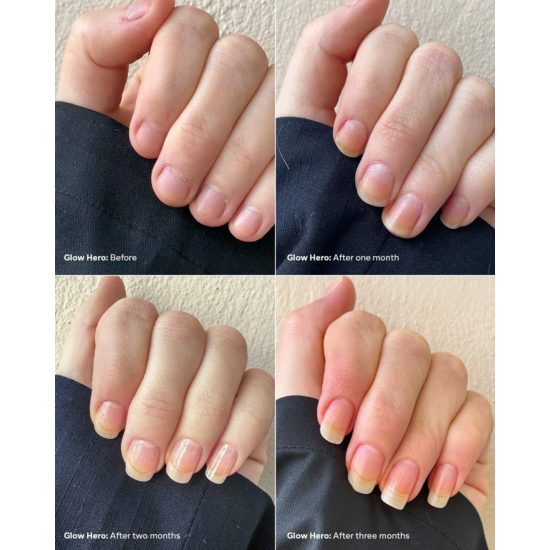 Dashl Glow Hero SOS Repair 10 ml