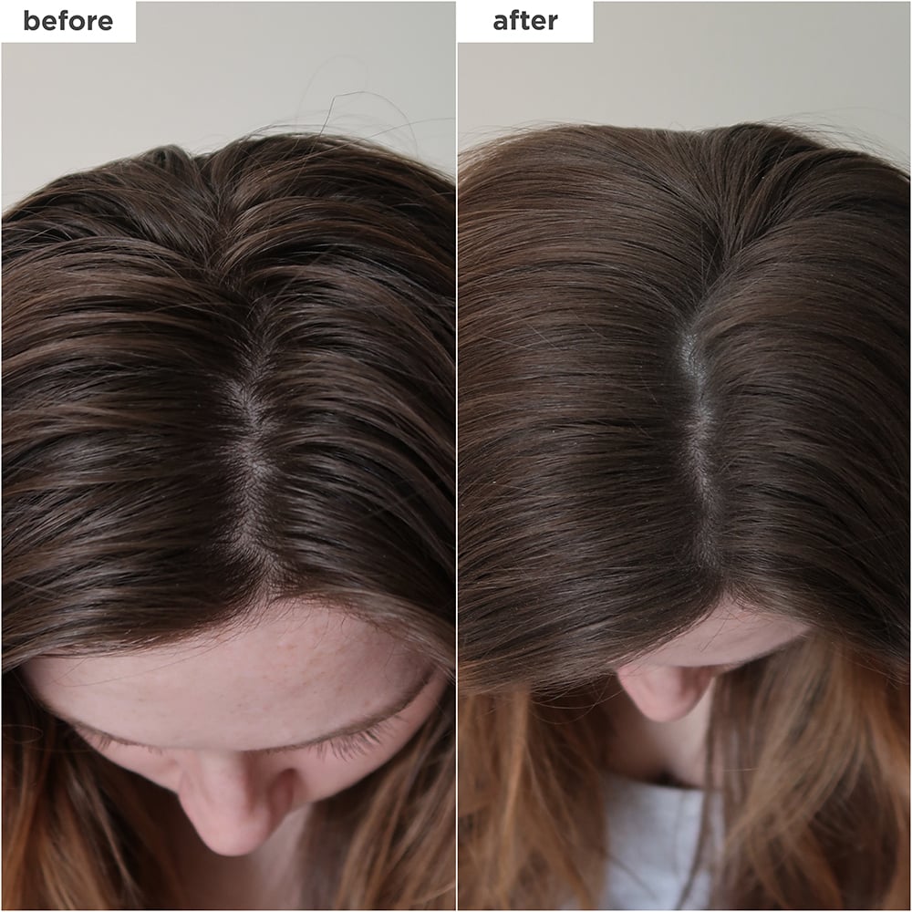 Briogeo Scalp Revival™ Dry Shampoo 50 g