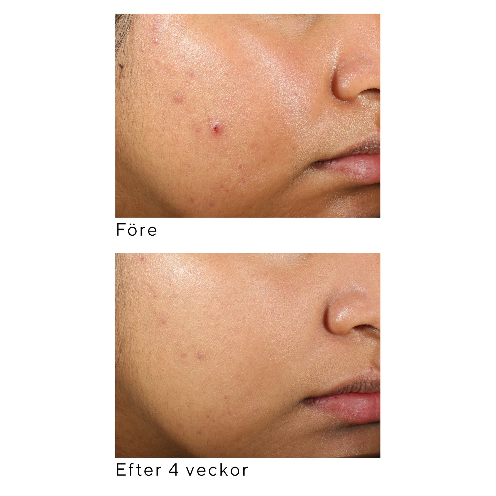 Murad Clarifying Water Gel 60 ml