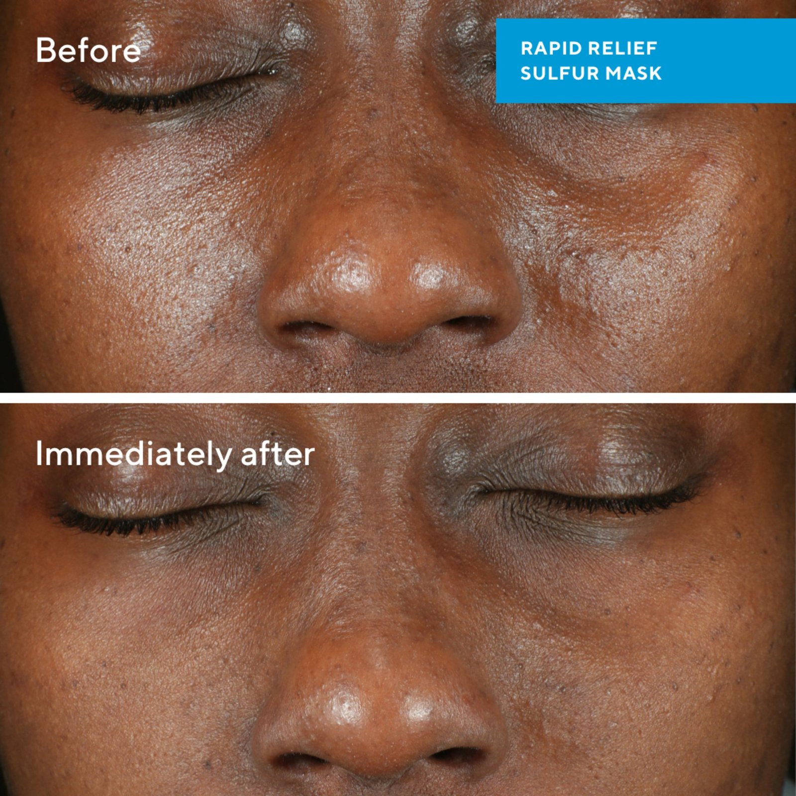 Murad Rapid Relief Sulfur Mask 75 ml