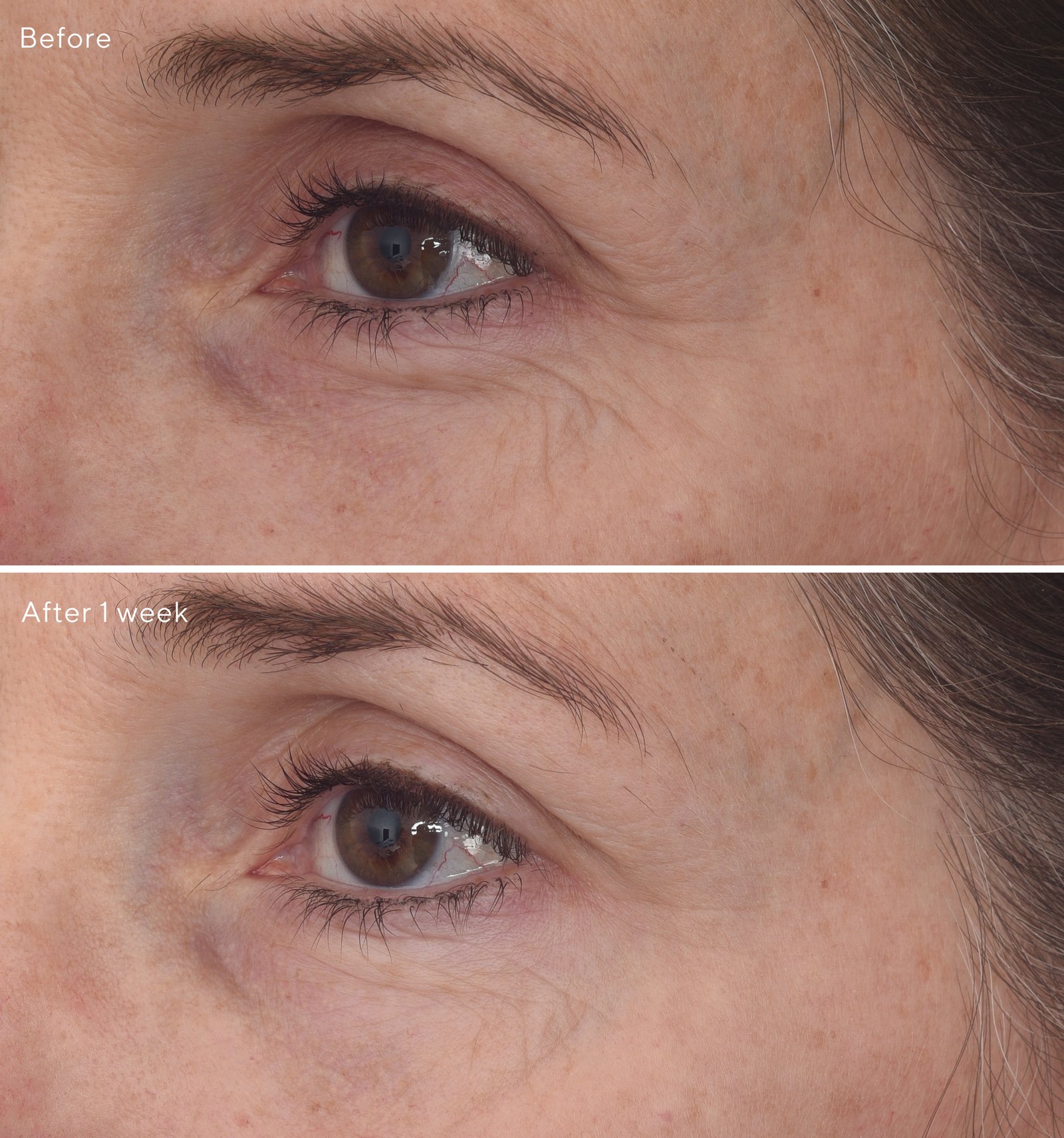 Murad Retinal ReSculpt Eye Lift Treatment