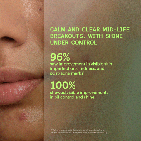 Murad Biome-Balancing Calm + Recover Cream 50 ml
