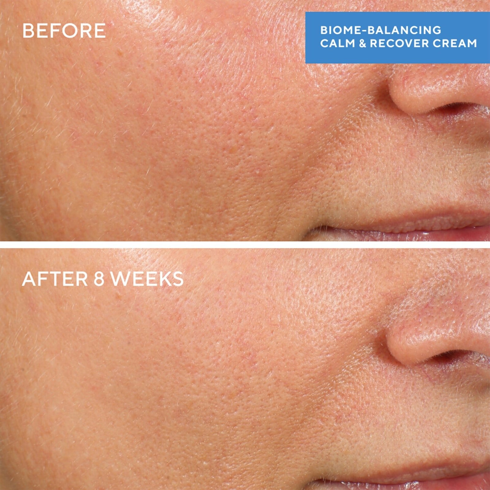 Murad Biome-Balancing Calm + Recover Cream 50 ml