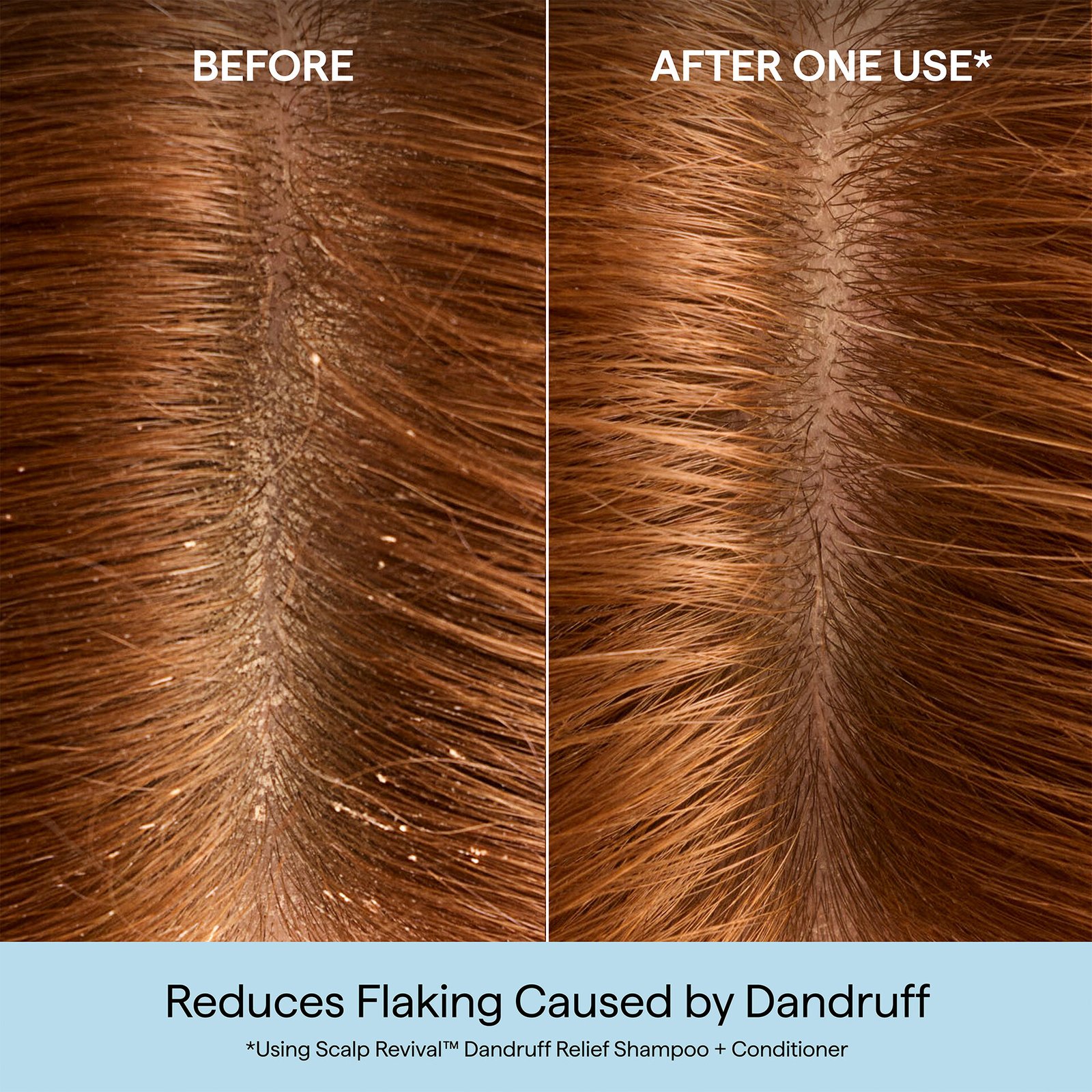 Briogeo Scalp Revival™ Dandruff Relief Conditioner 248 ml