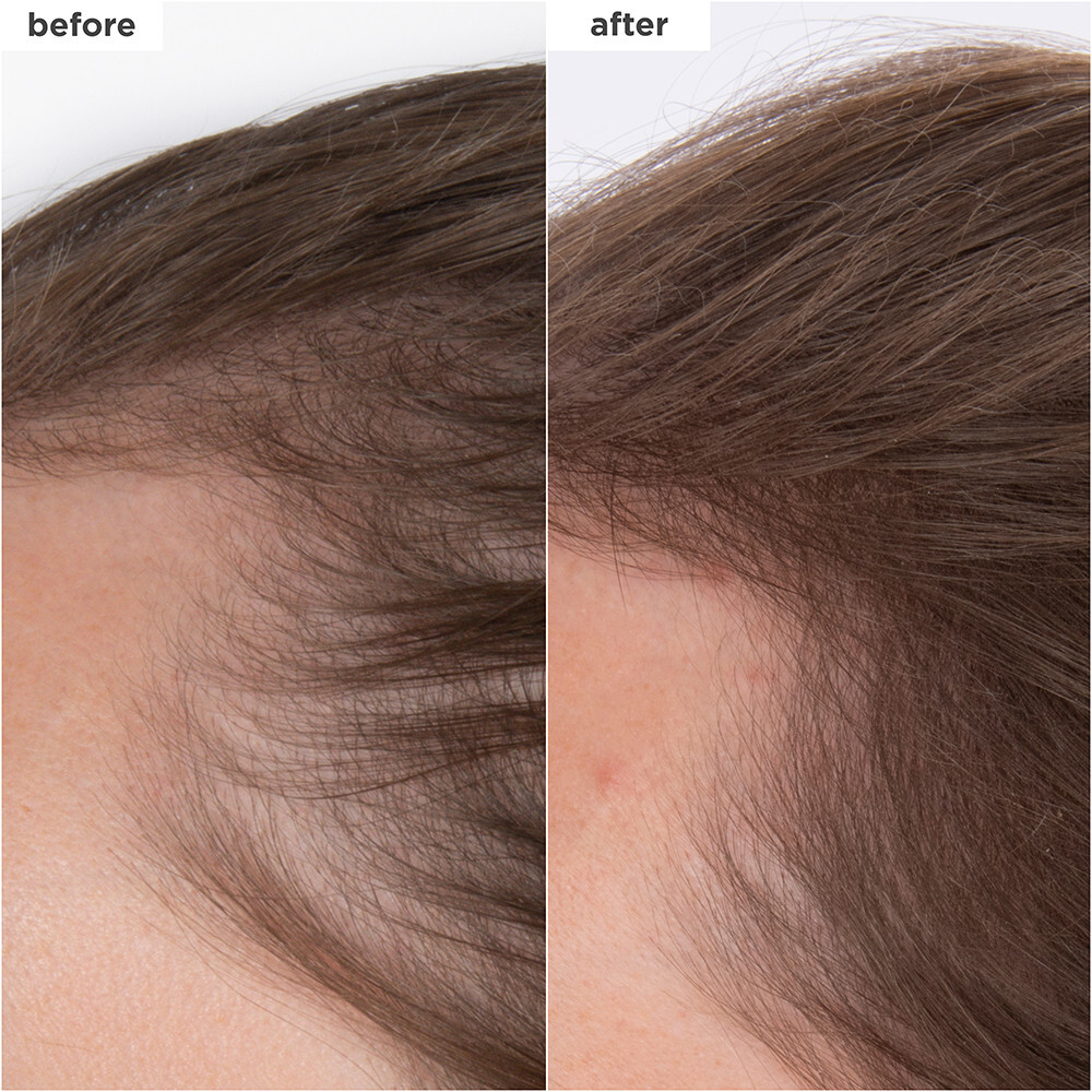 Briogeo Destined for Density™ Peptide Density Serum 45 ml
