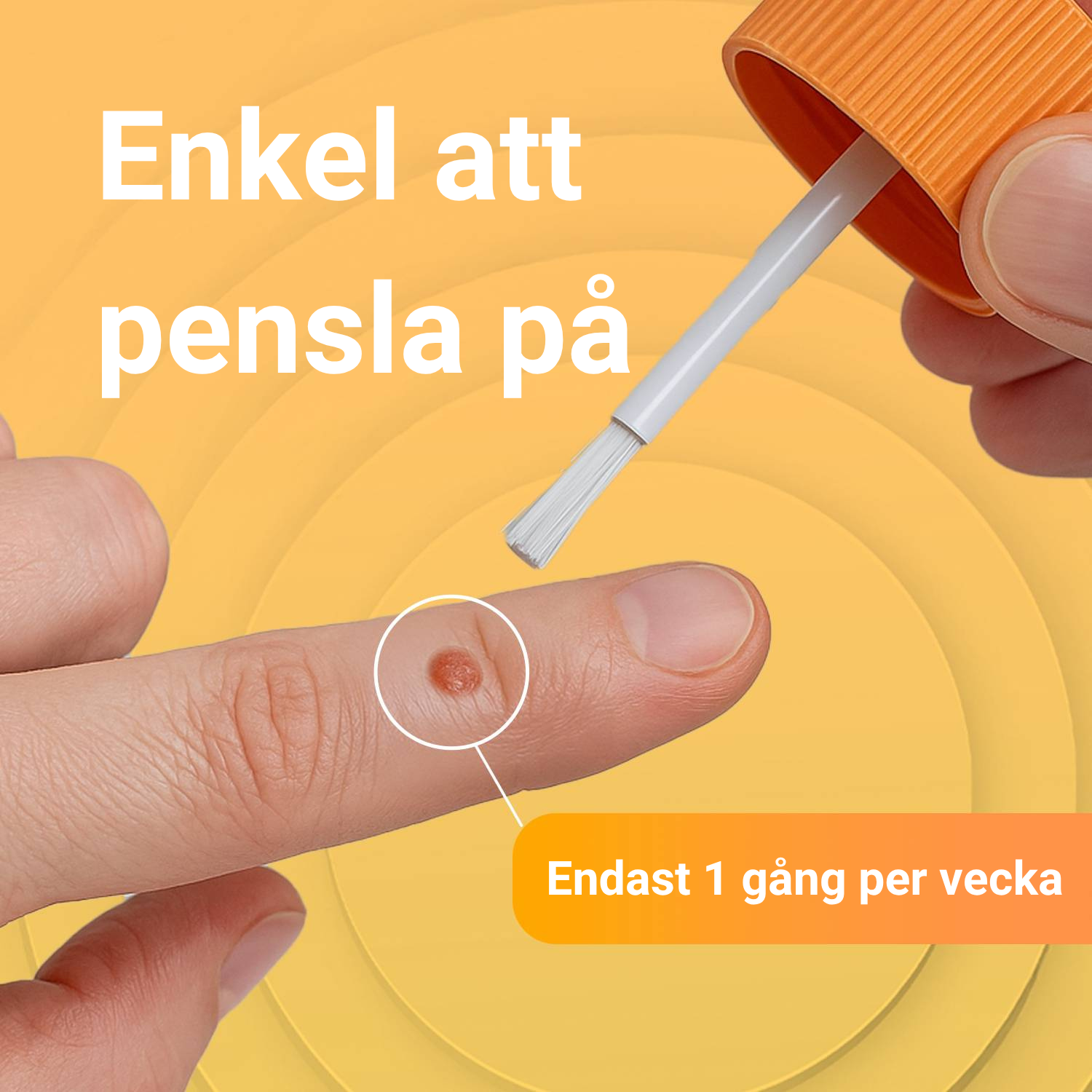 Vårtfri Original Vårtbehandling 5 ml