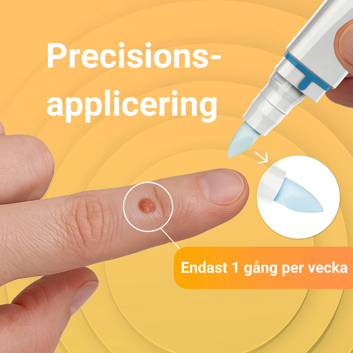 VårtFri Pen 30 behandlingar