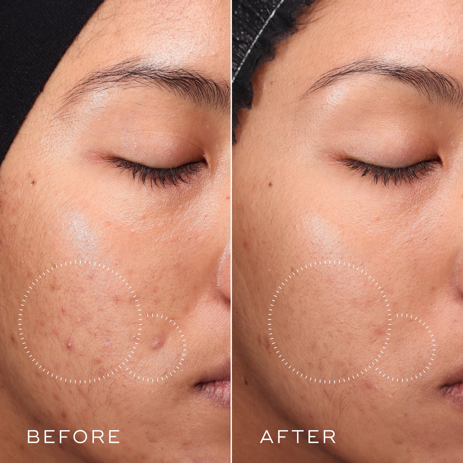 Medik8 Press & Clear 150ml