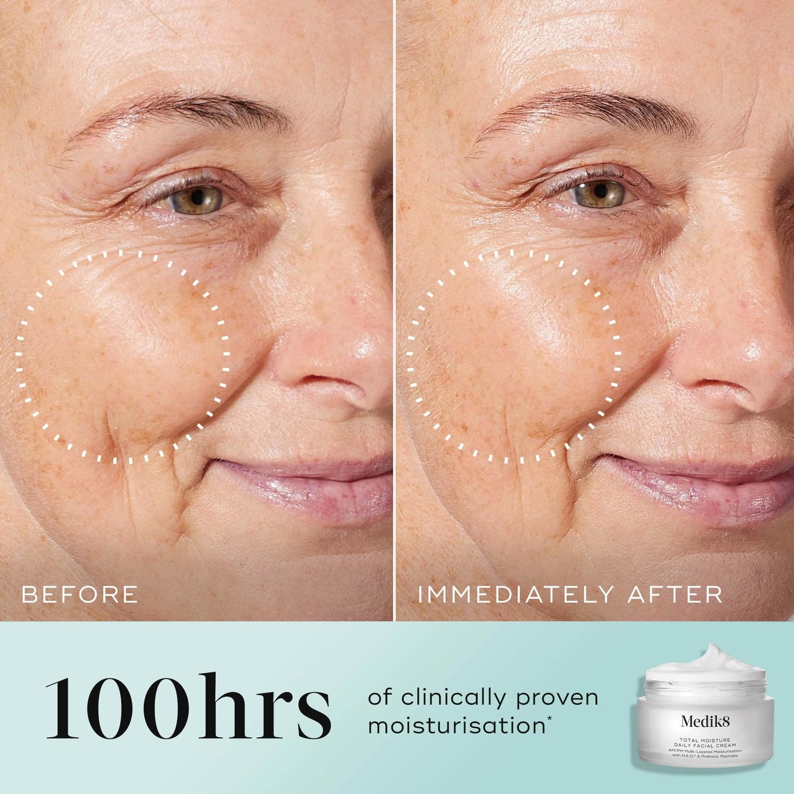 Medik8 Total Moisture Daily Facial Cream 50 ml