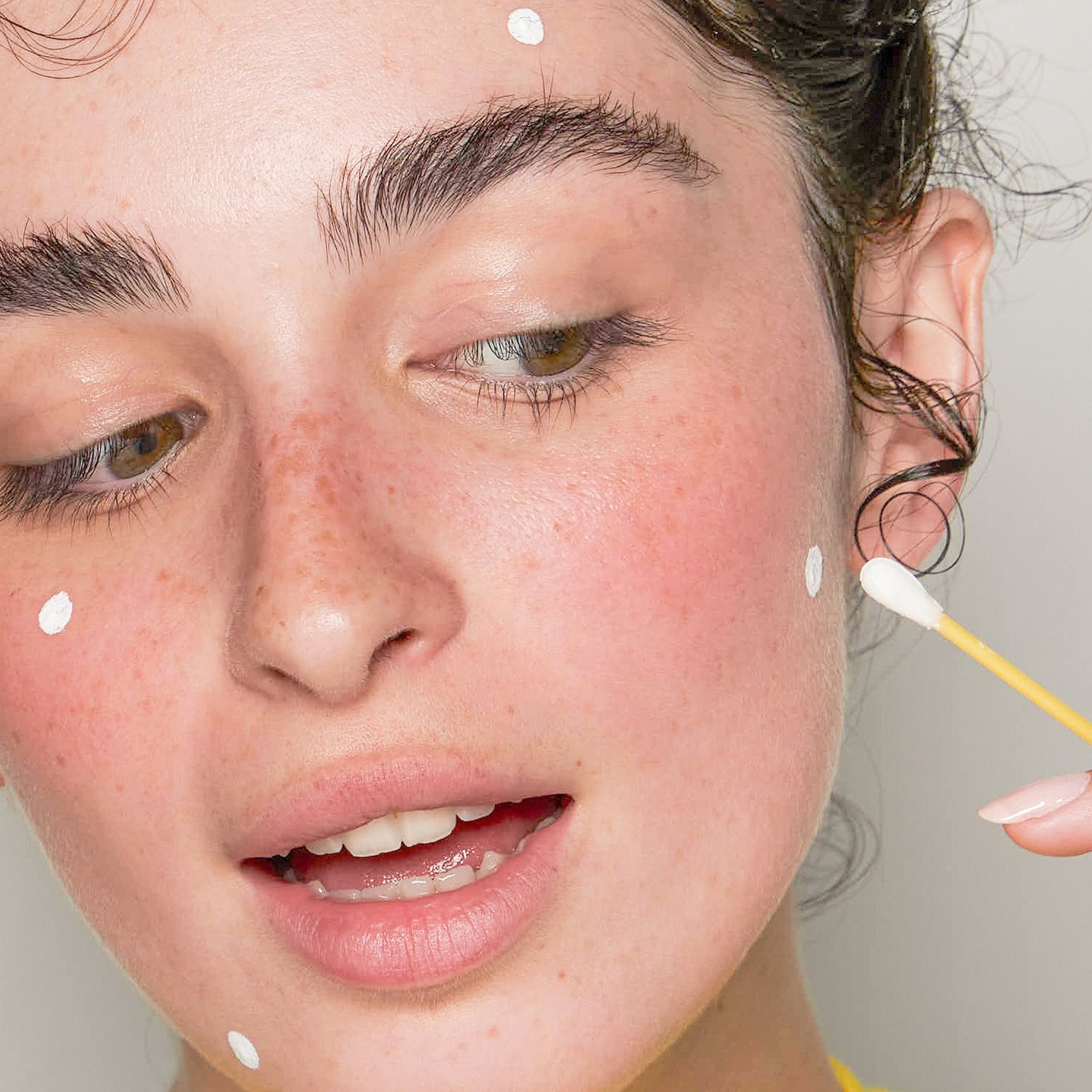 Niche Beauty Lab Acnemy Dryzit Spot Drying Lotion 30 ml