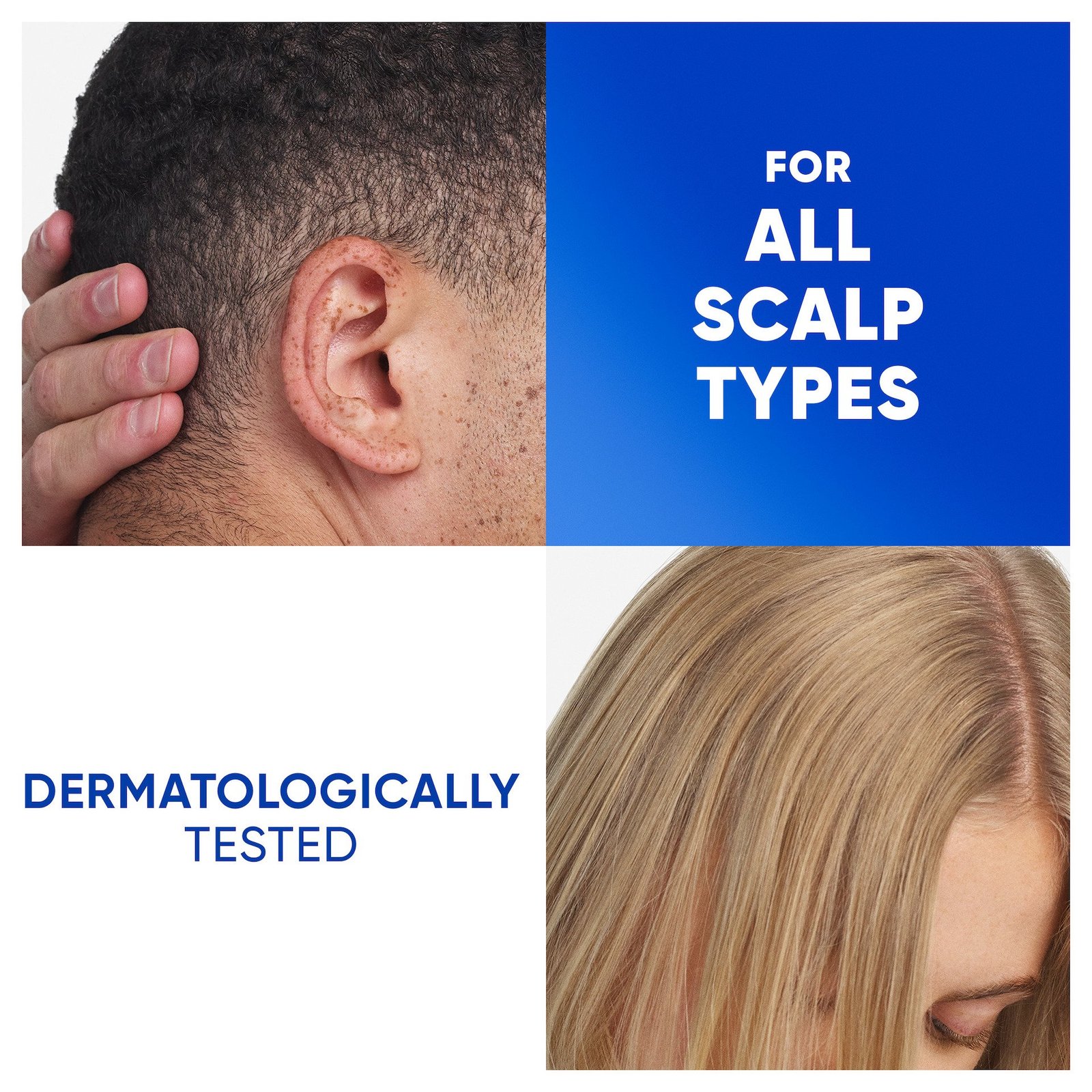 Head & Shoulders Apple Fresh Schampo mot mjäll 250 ml