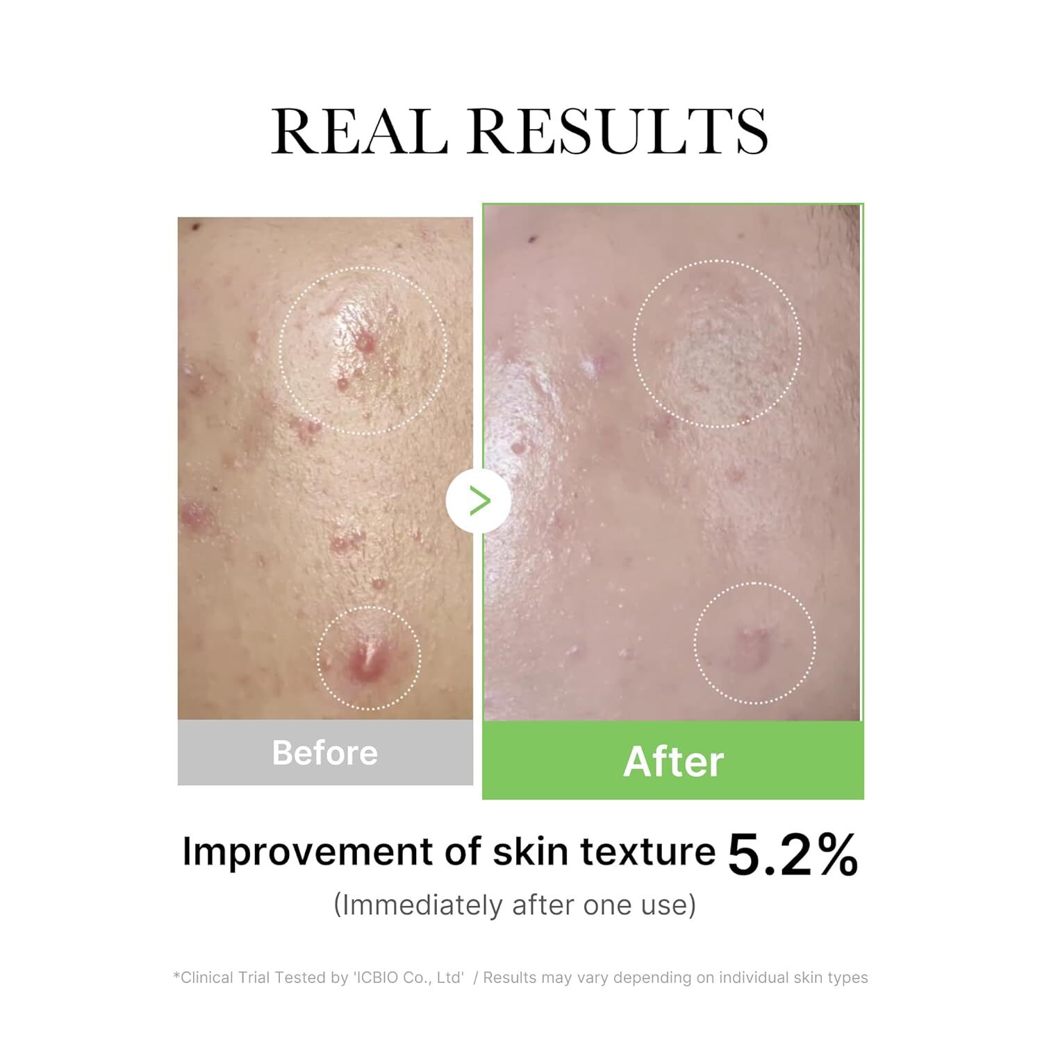 Medicube Exosome Cica Ampoule 30 ml