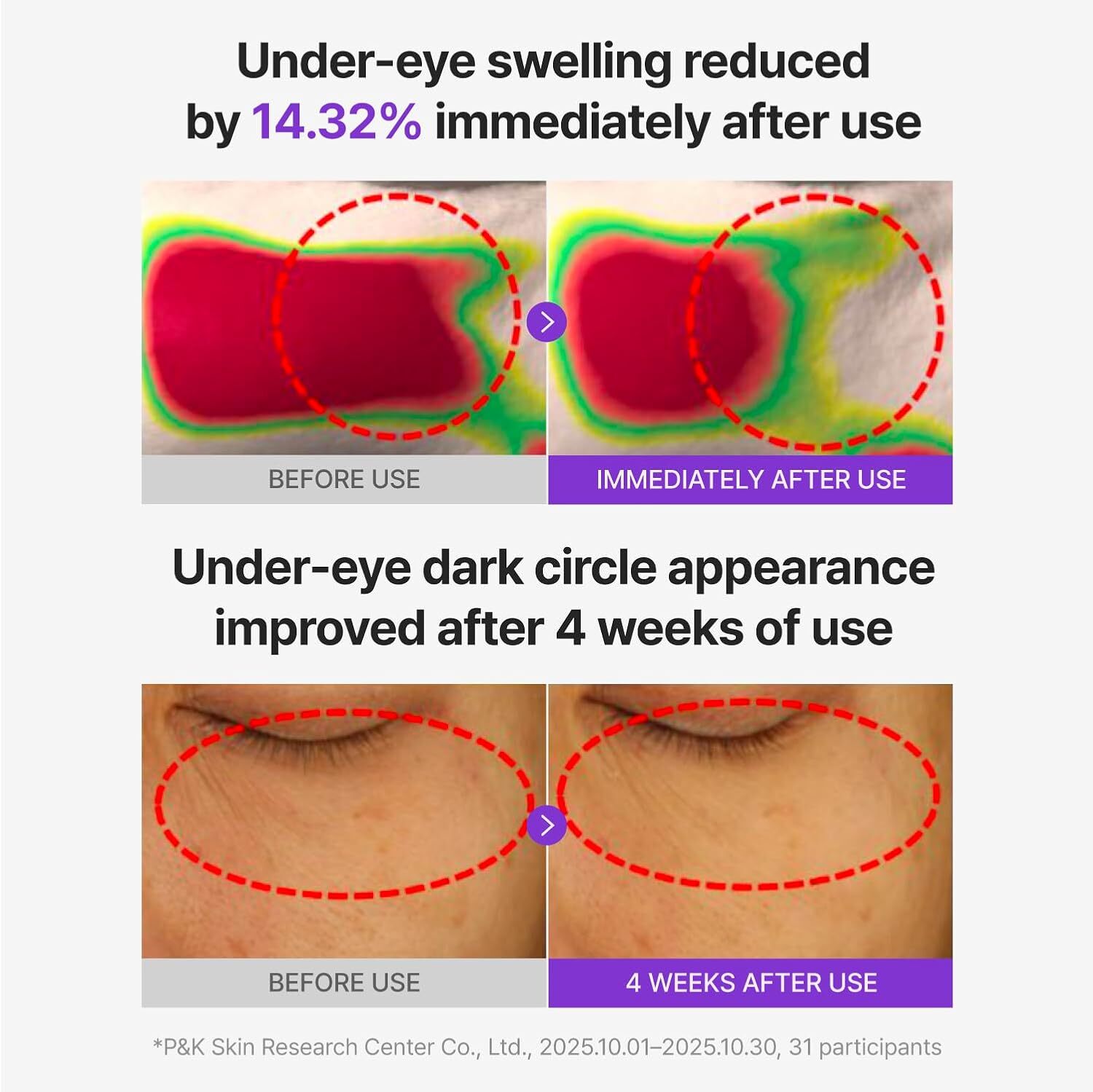 Centellian24 360º Shot PDRN Glowing Eye Patch 6 Par