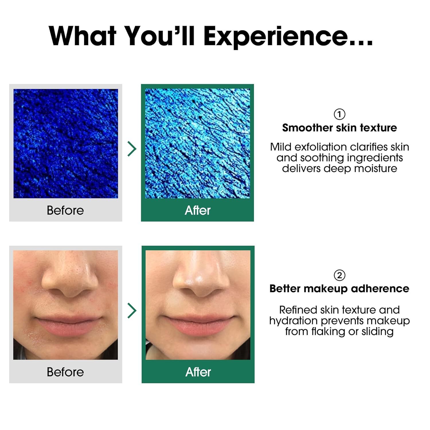 Some By Mi Aha-Bha-Pha 30 Days Miracle Toner 150 ml