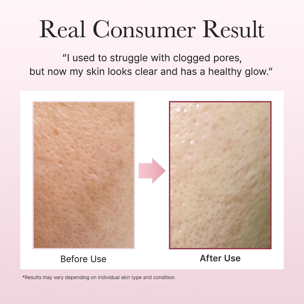 Arencia Fresh Rosehip Rice Mochi Cleanser 120 g