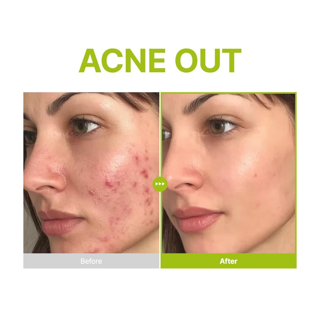 PURITO Azelaic Acid 10 Kojic Azulene Serum 30 ml