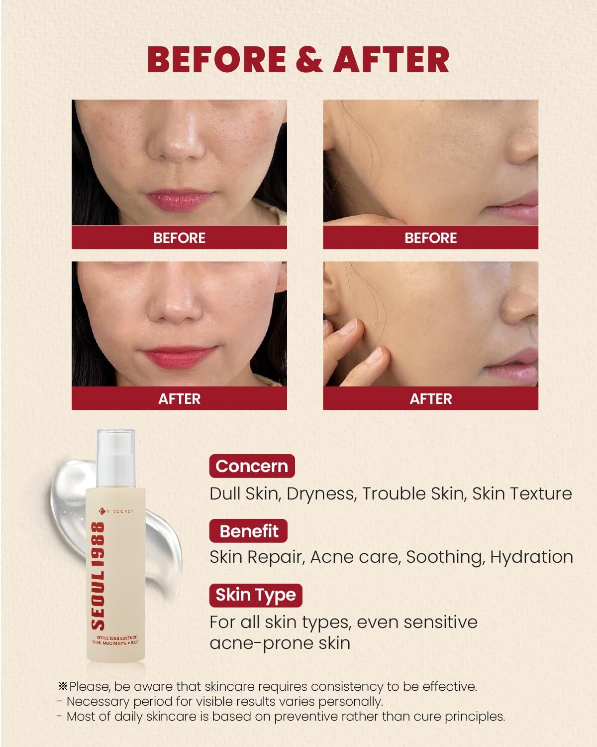 K-Secret SEOUL 1988 Essence : Snail Mucin 97% + Rice 100 ml