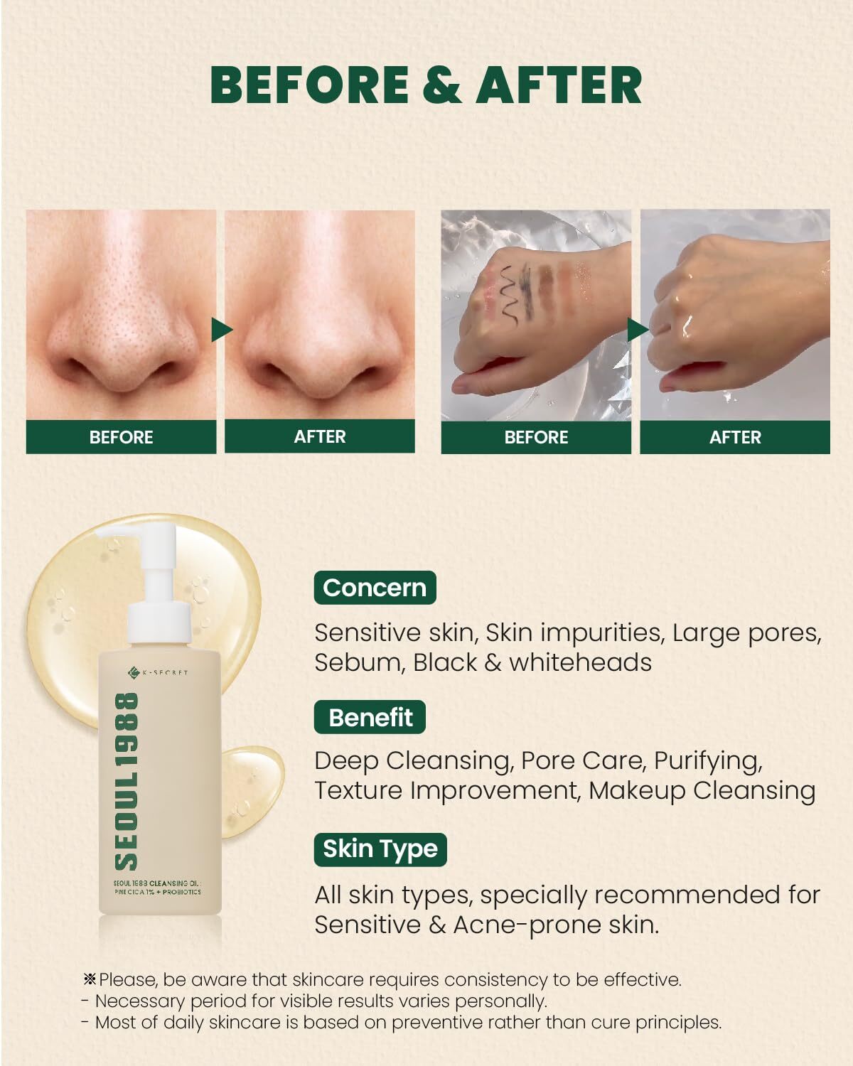 K-Secret SEOUL 1988 Cleansing Oil : Pine Cica 1% + Probiotics 200 ml