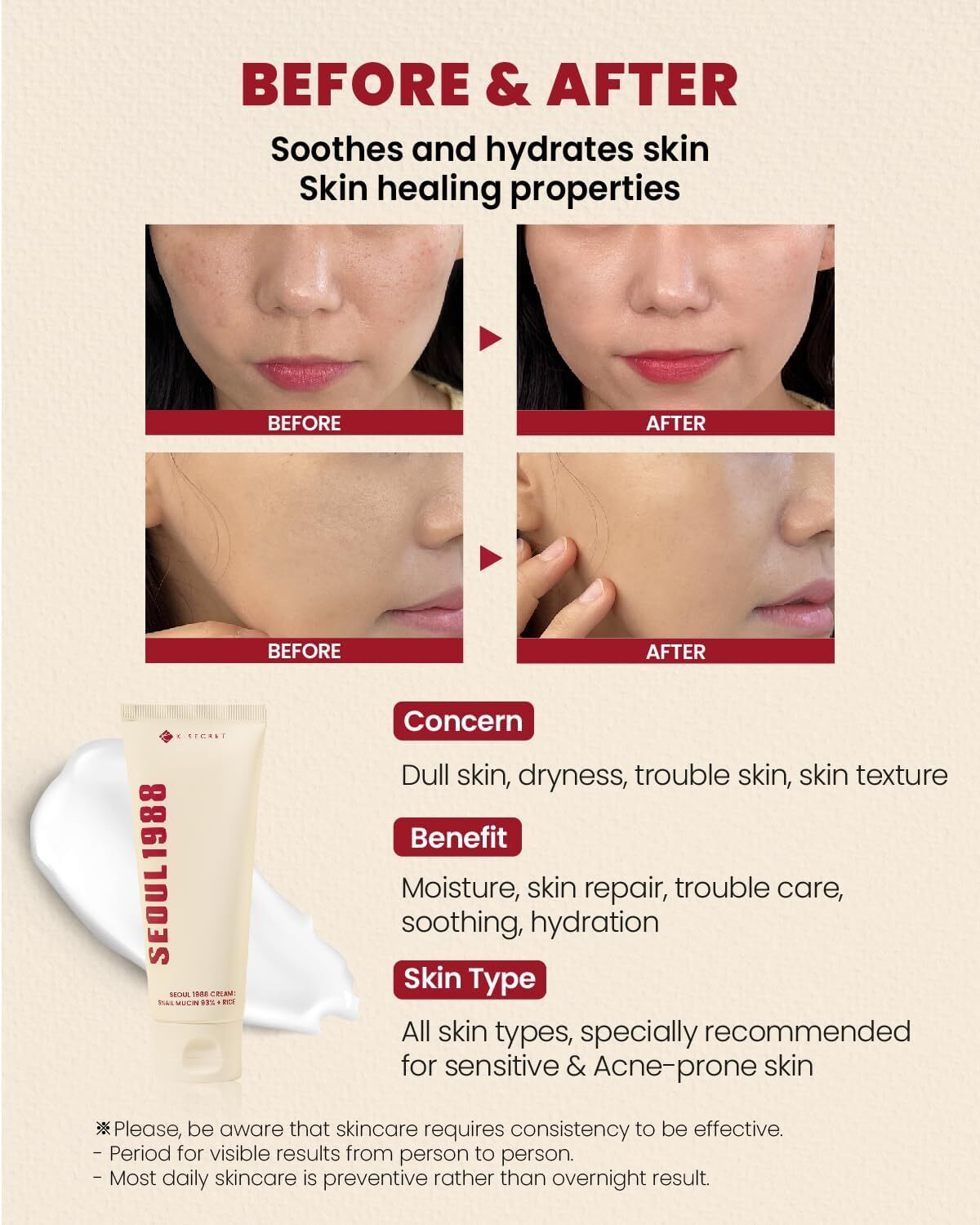 K-Secret SEOUL 1988 Cream : Snail Mucin 93% + Rice 100 ml