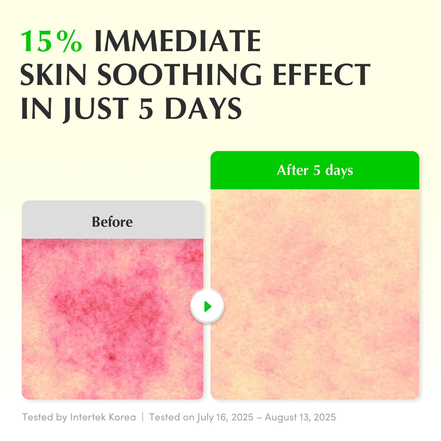 EQQUALBERRY Aloe PDRN Calming Serum 30 ml