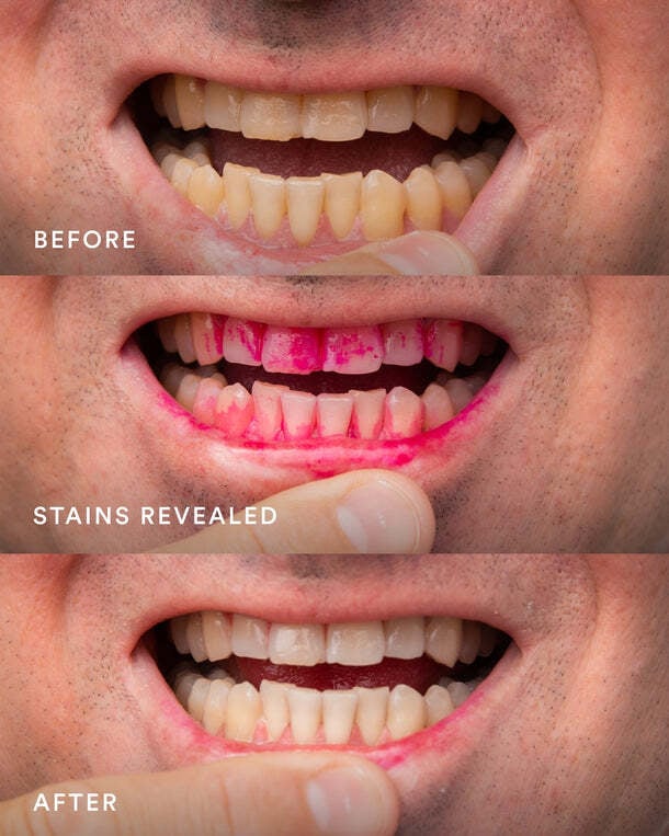 Hismile iD Stain Eraser 63 ml