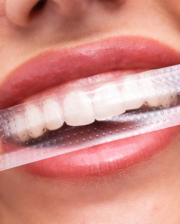 Hismile PAP+ Whitening Strips 7 st