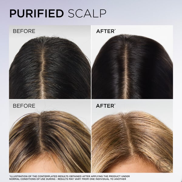 L'Oréal Paris Elvital Hyaluron Pure Schampo För Fuktfattigt Hår 500 ml