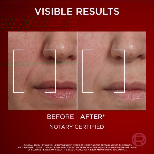 L'Oréal Paris Revitalift Laser Day Cream  50 ml