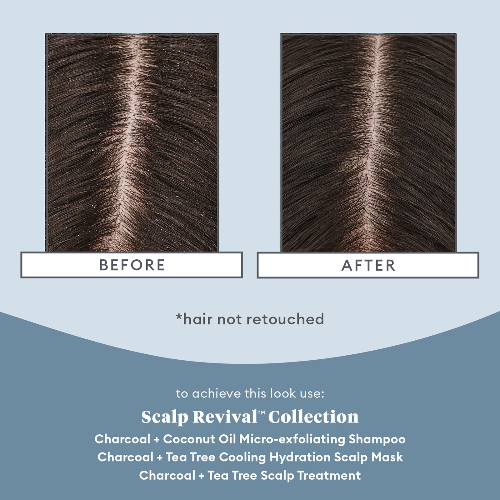 Briogeo Scalp Revival Charcoal + Tea Tree Cooling Hydration Scalp Mask 177 ml