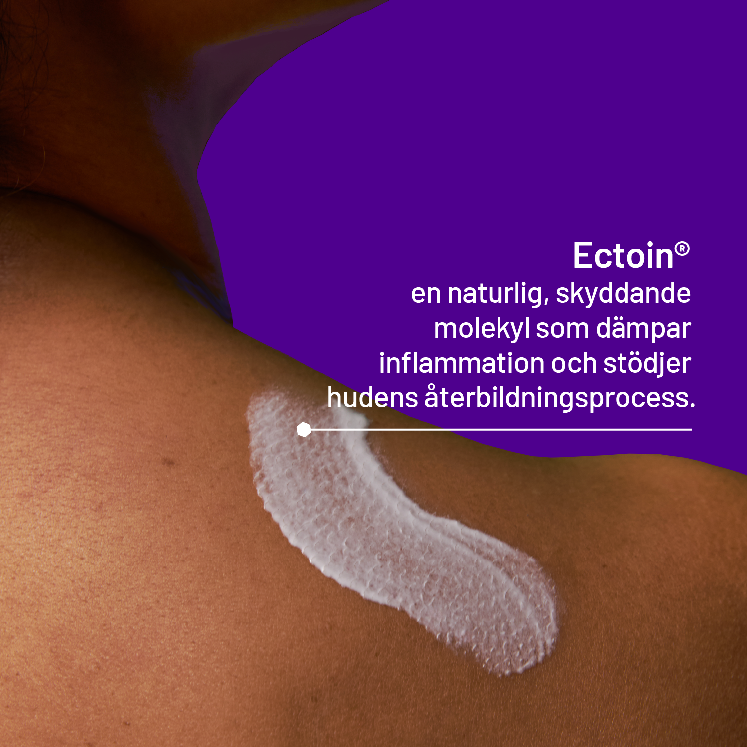 Locobase Psoriasis Cream 50 ml
