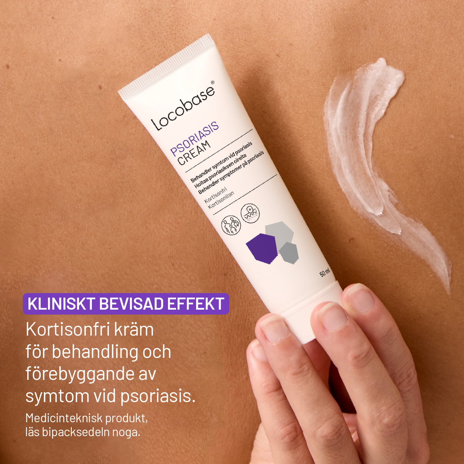 Locobase Psoriasis Cream 50 ml