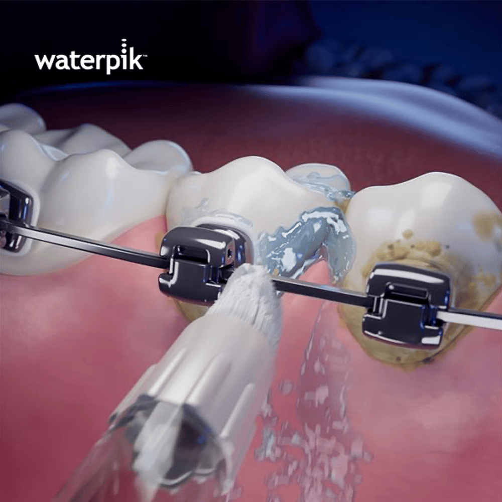 Waterpik OD-100E Orthodontic Tip 2 st