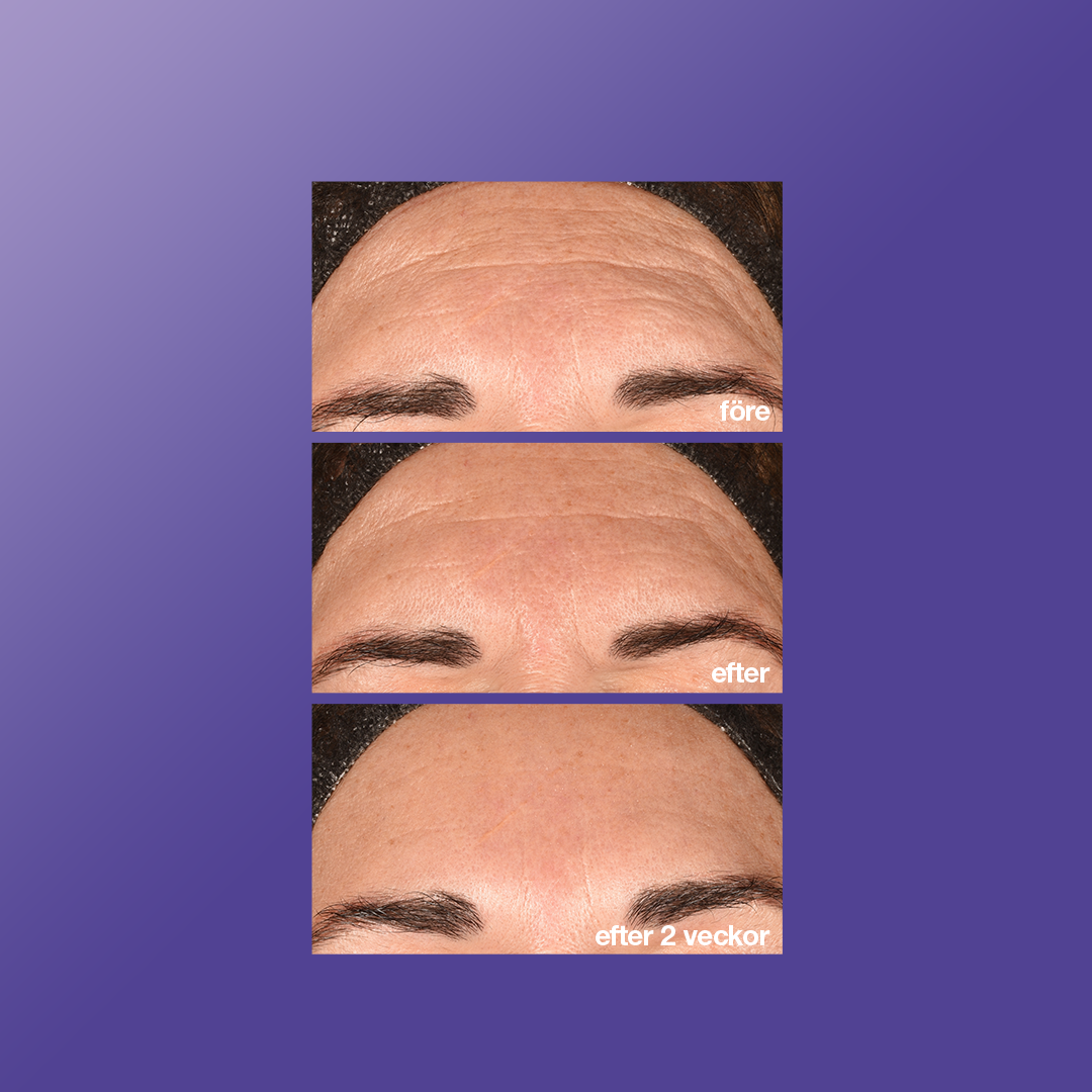 Dermalogica Phyto Nature E² 100 ml