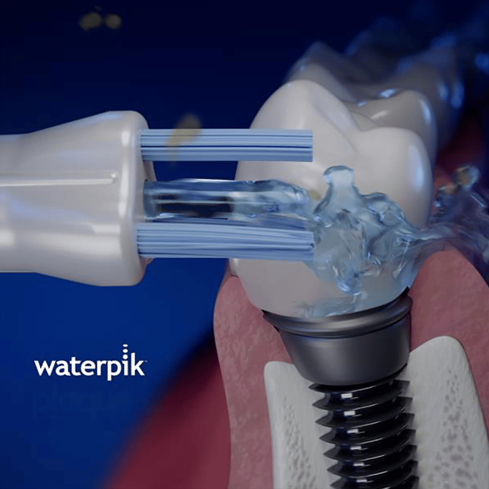 Waterpik PS-100E Plaque Seeker Tip 2 st