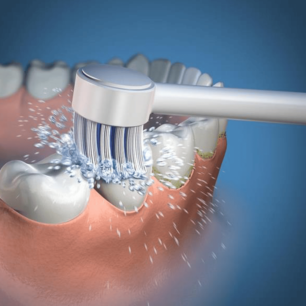 Waterpik TB-100E Water Flosser Toothbrush Tip