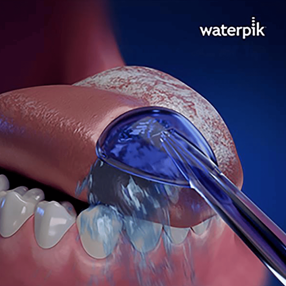 Waterpik TC-100E Water Flosser Tongue Cleaner