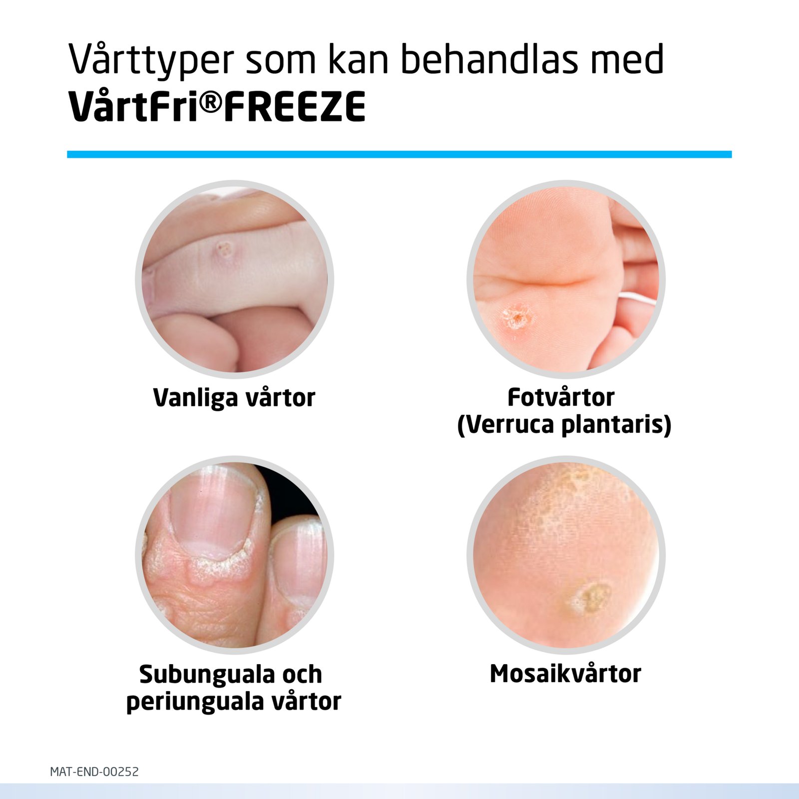VårtFri Freeze 14,3 g