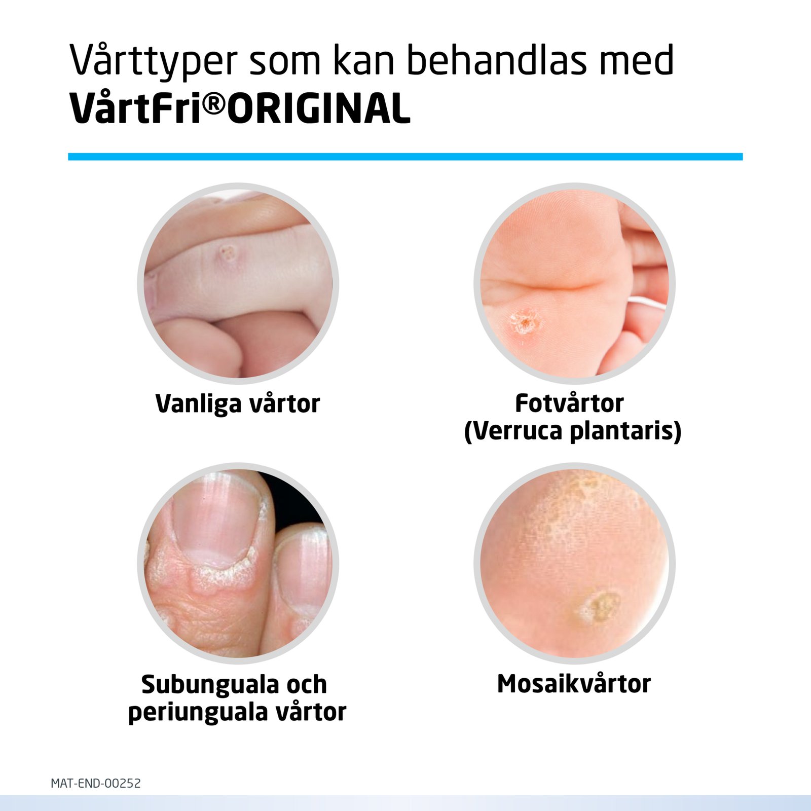 Vårtfri Original Vårtbehandling 5 ml